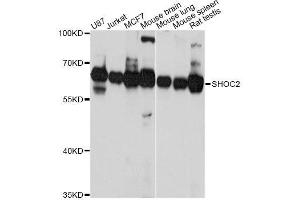 Western blot analysis of extracts of various cell lines, using SHOC2 Antibody. (SHoc2/Sur8 Antikörper  (AA 1-280))