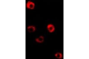 Immunofluorescent analysis of Tropomyosin 3 staining in Hela cells. (TPM3 Antikörper)