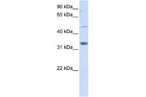 WB Suggested Anti-ZCCHC17 Antibody Titration:  0. (ZCCHC17 Antikörper  (Middle Region))