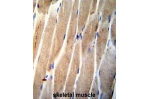 CLEC4F Antibody (C-term) immunohistochemistry analysis in formalin fixed and paraffin embedded human skeletal muscle followed by peroxidase conjugation of the secondary antibody and DAB staining. (CLEC4F Antikörper  (C-Term))