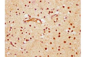 IHC image of ABIN7145804 diluted at 1:600 and staining in paraffin-embedded human brain tissue performed on a Leica BondTM system. (BRD1 Antikörper  (AA 756-879))