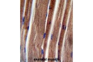 THUM3 Antibody (Center) immunohistochemistry analysis in formalin fixed and paraffin embedded human skeletal muscle followed by peroxidase conjugation of the secondary antibody and DAB staining. (THUMPD3 Antikörper  (Middle Region))