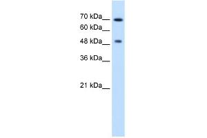 WB Suggested Anti-RAD23A Antibody Titration:  2. (RAD23A Antikörper  (N-Term))