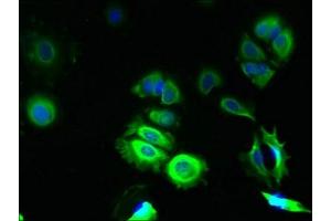 Immunofluorescent analysis of MCF-7 cells using ABIN7172949 at dilution of 1:100 and Alexa Fluor 488-congugated AffiniPure Goat Anti-Rabbit IgG(H+L) (TMCO5A Antikörper  (AA 10-192))