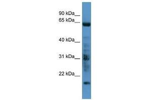 GRK7 antibody used at 0. (GRK7 Antikörper  (C-Term))