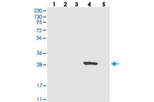 Western blot analysis of Lane 1: RT-4, Lane 2: U-251 MG, Lane 3: Human Plasma, Lane 4: Liver, Lane 5: Tonsil with DULLARD polyclonal antibody . (CTDNEP1A Antikörper)