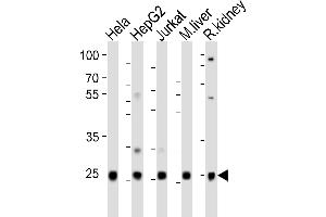 Western blot analysis of lysates from Hela, HepG2, Jurkat cell line, mouse liver, rat kidney tissue(from left to right), using UBB(Ubiquitin) Antibody (N-term) (ABIN6242685 and ABIN6577623). (Ubiquitin B Antikörper  (N-Term))