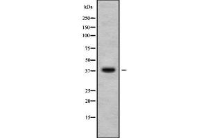 Western blot analysis of CA10 using HuvEc whole cell lysates (CA10 Antikörper  (C-Term))