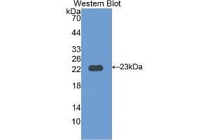 Western blot analysis of the recombinant protein. (IL12RB1 Antikörper  (AA 37-234))