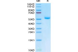 Mouse EVA-1 on Tris-Bis PAGE under reduced condition. (MPZL2 Protein (AA 27-154) (Fc Tag))