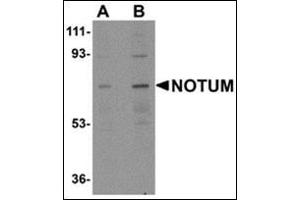 Western blot analysis of NOTUM AP30609PU-N antibody in Human kidney tissue lysate at 0.