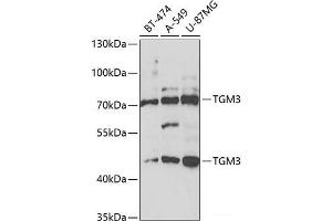 Western blot analysis of extracts of various cell lines using TGM3 Polyclonal Antibody at dilution of 1:1000. (TGM3 Antikörper)