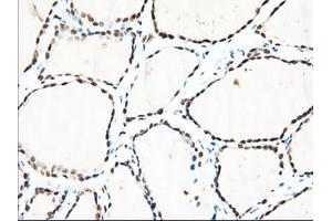 Immunohistochemical staining of paraffin-embedded Human lung tissue using anti-TACC3 mouse monoclonal antibody. (TACC3 Antikörper)