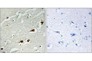 Immunohistochemistry (IHC) image for anti-Nuclear Factor-kB p65 (NFkBP65) (AA 496-545) antibody (ABIN2889033) (NF-kB p65 Antikörper  (AA 496-545))