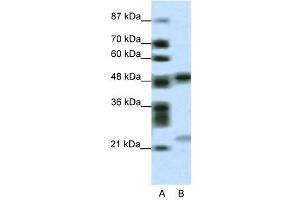 WB Suggested Anti-PHF11  Antibody Titration: 0. (PHF11 Antikörper  (Middle Region))
