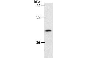 Western Blot analysis of 231 cell using PLAT Polyclonal Antibody at dilution of 1:450 (PLAT Antikörper)