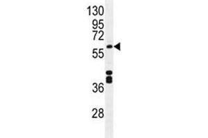 CYP1A2 antibody western blot analysis in mouse liver tissue lysate. (CYP1A2 Antikörper  (AA 255-282))