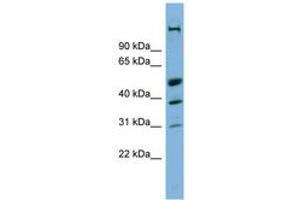 Image no. 1 for anti-CREB/ATF BZIP Transcription Factor (CREBZF) (AA 215-264) antibody (ABIN6742074) (CREBZF Antikörper  (AA 215-264))