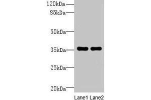 Western blot All lanes: NAIF1 antibody at 6 μg/mL Lane 1: Mouse brain tissue Lane 2: Mouse heart tissue Secondary Goat polyclonal to rabbit IgG at 1/10000 dilution Predicted band size: 36, 18 kDa Observed band size: 36 kDa (NAIF1 Antikörper  (AA 1-172))