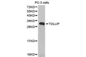 Western Blotting (WB) image for anti-Toll Interacting Protein (TOLLIP) antibody (ABIN1875154)