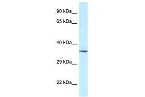 Western Blot showing NUDT6 antibody used at a concentration of 1 ug/ml against Fetal Brain Lysate