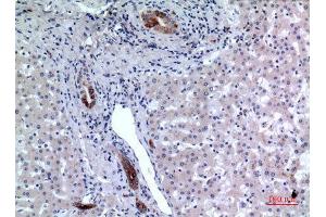 Immunohistochemistry (IHC) analysis of paraffin-embedded Human Liver, antibody was diluted at 1:100.
