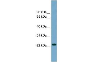 Human THP-1; WB Suggested Anti-ARL8B Antibody Titration: 0. (ARL8B Antikörper  (Middle Region))