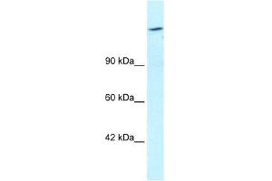 Human HepG2; WB Suggested Anti-ARID4A Antibody Titration: 1. (ARID4A Antikörper  (C-Term))
