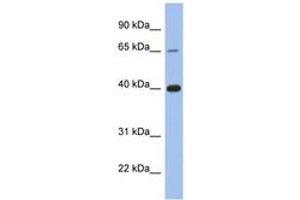 Image no. 1 for anti-Estrogen Receptor 1 (ESR1) (C-Term) antibody (ABIN6746024) (Estrogen Receptor alpha Antikörper  (C-Term))