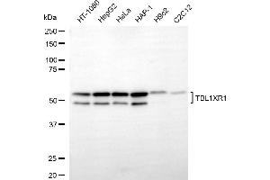 anti-Transducin (Beta)-Like 1 X-Linked Receptor 1 (TBL1XR1) antibody