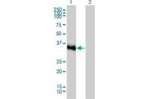 Western Blot analysis of CRX expression in transfected 293T cell line by CRX monoclonal antibody (M02), clone 4G11. (CRX Antikörper  (AA 1-95))