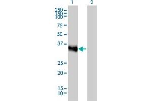 Western Blot analysis of CRX expression in transfected 293T cell line by CRX monoclonal antibody (M02), clone 4G11.