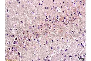 Formalin-fixed and paraffin embedded: rat brain tissue labeled with Anti-GAP-43 Polyclonal Antibody, Unconjugated (ABIN725555) at 1:300 followed by conjugation to the secondary antibody and DAB staining (GAP43 Antikörper  (AA 9-100))