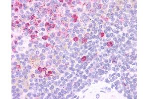 Anti-HCAR3 / GPR109B / HM74 antibody IHC of human spleen. (GPR109B Antikörper  (Cytoplasmic Domain))