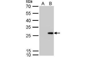 WB Image Calretinin antibody detects CALB2 protein by Western blot analysis. (Calretinin Antikörper)