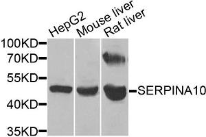 Western blot analysis of extracts of various cell lines, using SERPINA10 antibody (ABIN5974273) at 1/1000 dilution. (SERPINA10 Antikörper)
