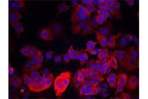 Immunofluorescence (IF) image for anti-Keratin 19 (KRT19) antibody (ABIN2664919)