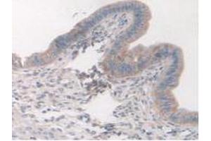 Figure. (Cortactin Antikörper  (AA 1-509))