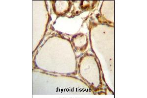 HJURP Antibody (C-term) (ABIN657329 and ABIN2846399) immunohistochemistry analysis in formalin fixed and paraffin embedded human thyroid tissue followed by peroxidase conjugation of the secondary antibody and DAB staining. (HJURP Antikörper  (C-Term))