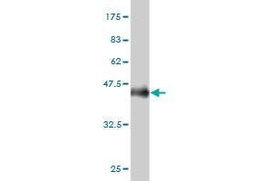 Western Blot detection against Immunogen (36. (PPFIBP2 Antikörper  (AA 1-100))