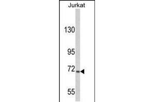Western blot analysis of hUSP19-L1304 in Jurkat cell line lysates (35ug/lane)