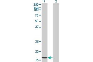 Western Blot analysis of STK10 expression in transfected 293T cell line by STK10 MaxPab polyclonal antibody. (STK10-A Antikörper  (AA 12-144))