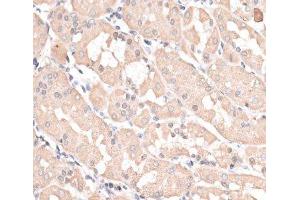 Immunohistochemistry of paraffin-embedded Human stomach using ABCC5 Polyclonal Antibody at dilution of 1:100 (40x lens). (ABCC5 Antikörper)