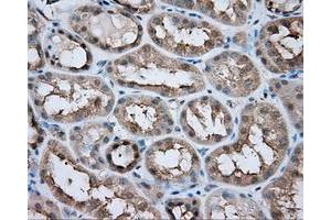 Immunohistochemical staining of paraffin-embedded liver tissue using anti-LIPG mouse monoclonal antibody. (LIPG Antikörper)