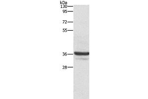Western Blot analysis of Lovo cell using ANXA3 Polyclonal Antibody at dilution of 1:650 (Annexin A3 Antikörper)