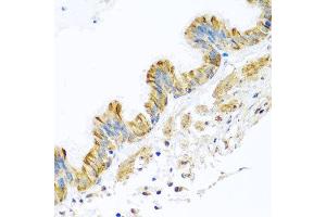 Immunohistochemistry of paraffin-embedded human trachea using PCDHA12 antibody at dilution of 1:100 (x40 lens).