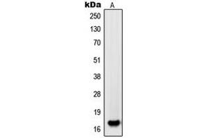 Western blot analysis of PDGFA expression in HL60 (A) whole cell lysates. (PDGFA Antikörper  (Center))