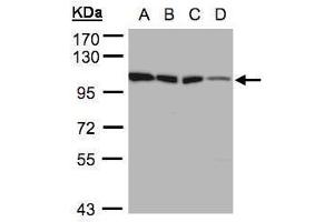 WB Image Sample(30 ug whole cell lysate) A:A431, B:H1299 C:HeLa S3, D:Hep G2 , 7. (Hexokinase 1 Antikörper)