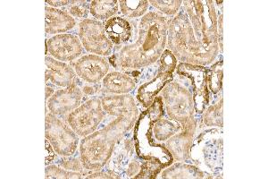 Immunohistochemistry of paraffin-embedded rat kidney using GPLD1 Rabbit pAb (ABIN6131716, ABIN6141335, ABIN6141336 and ABIN6222300) at dilution of 1:100 (40x lens).