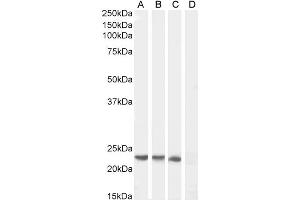 SOCS1 Antikörper  (C-Term)